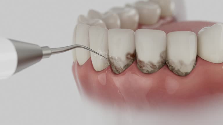 Reliable Dental contractor in Mill City, OR by Smile Center Dentistry
